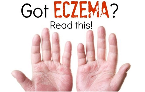 Top Three Tips To Stop Eczema In Kids And Adults