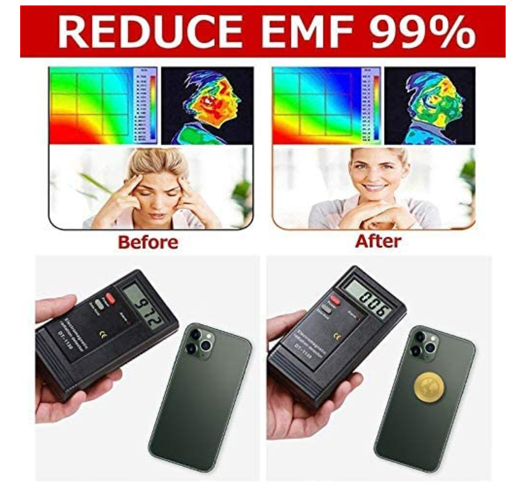 Radiation Protection Shield