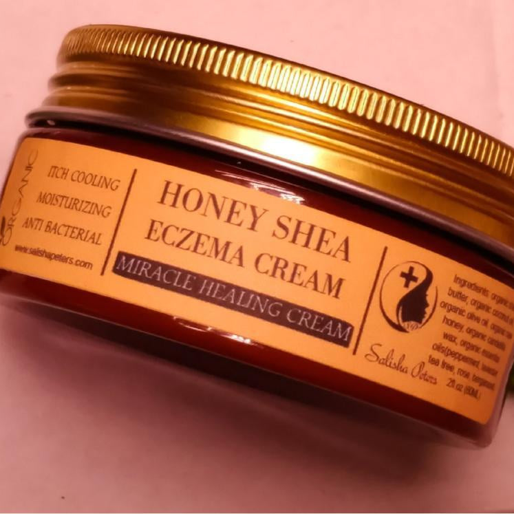 honey shea eczema healing cream