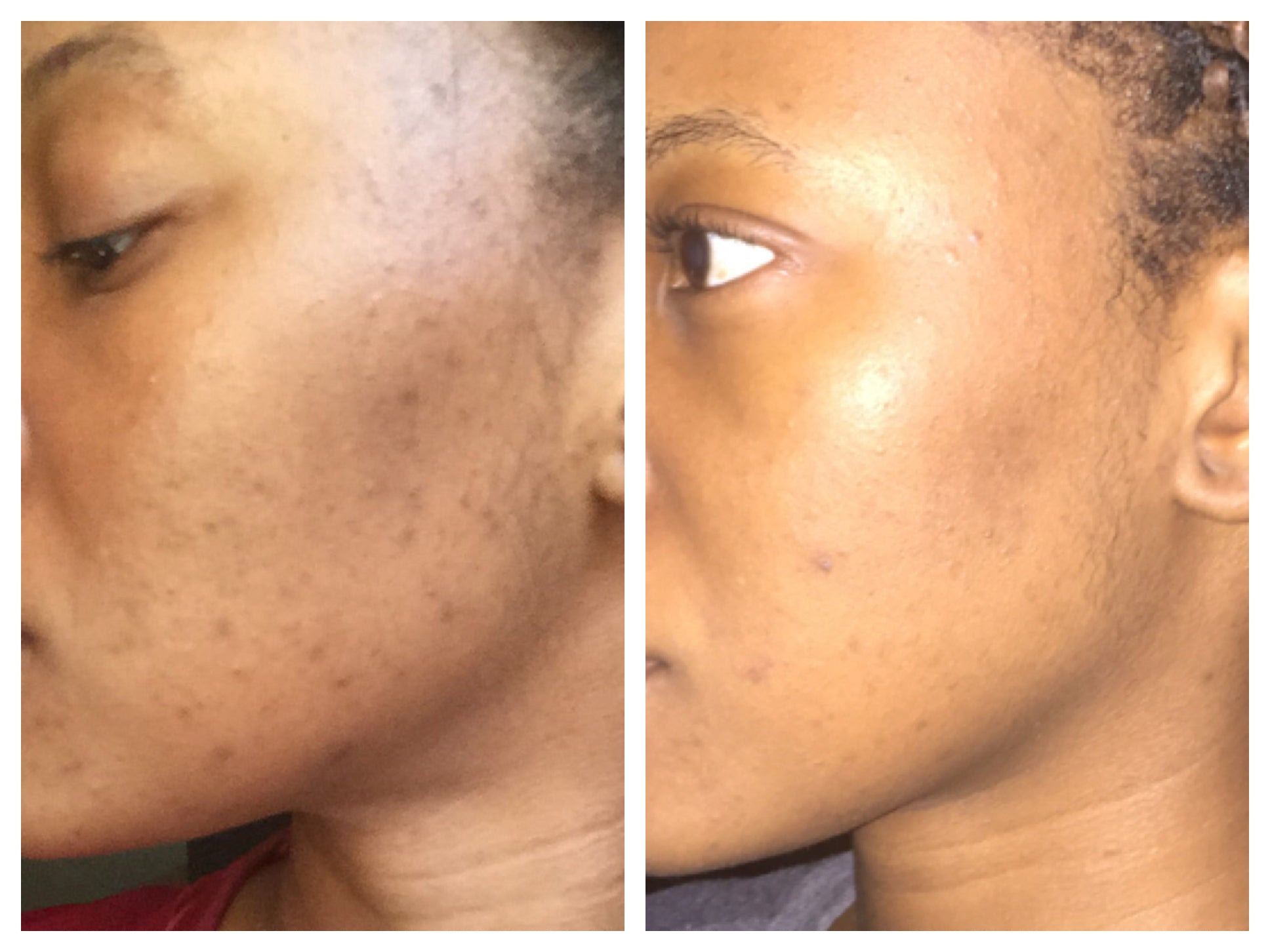 Organic African Black Soap